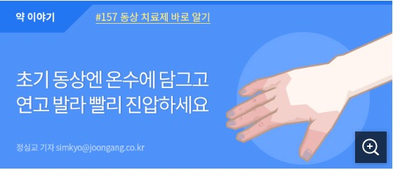 초기 동상엔 온수에 담그고 연고 발라 빨리 진압하세요